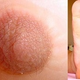 Illustration for article titled Woman Grows Full Size Nipple On Foot